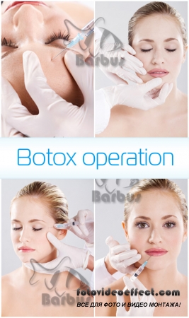 Botox operation /   - photo stock