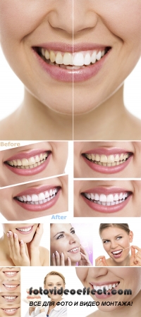 Stock Photo: Dentistry female with perfect toothy smile
